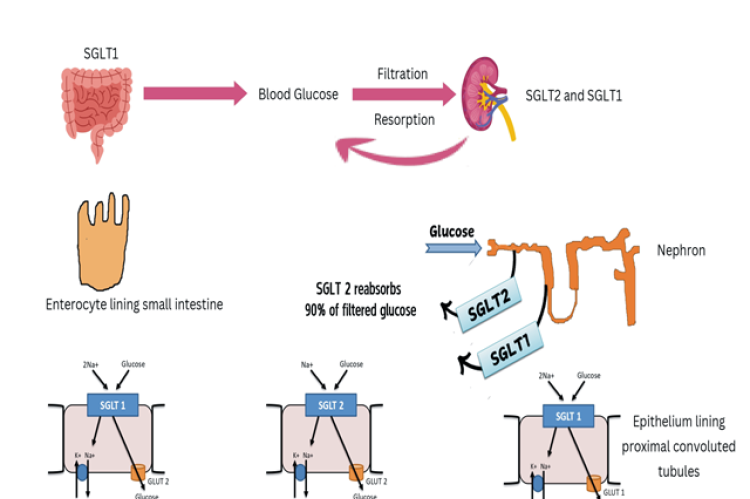 Protective mechanism of Empagliflozin on kidney.