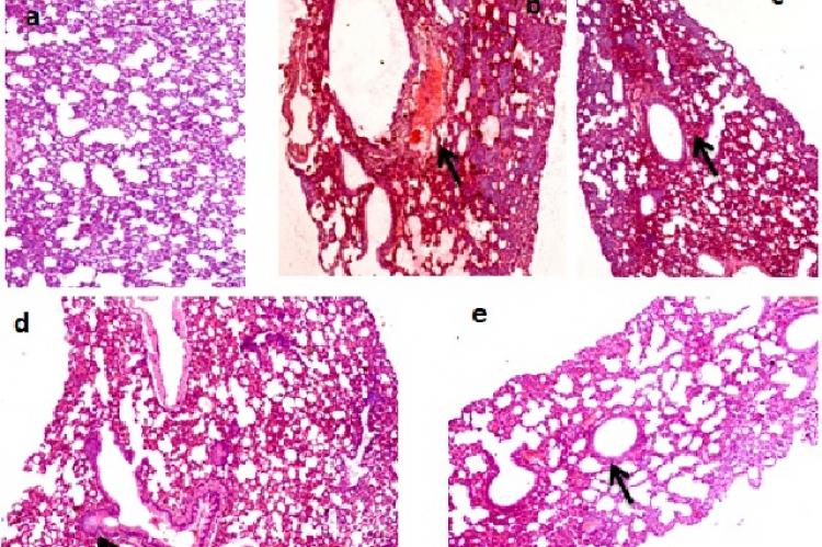 Histopathological evaluation